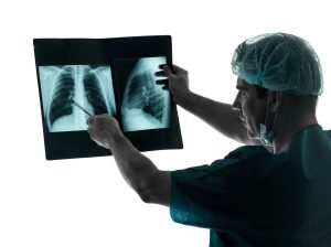 Doctor looking at lung x-ray