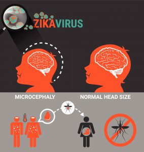 Zika and Microcephaly Diagram