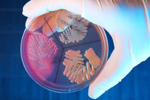 Samples of Bacteria in petri dish