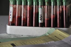 Test tubes with blood samples